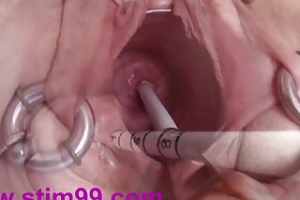 Extreme Real Cervix Fucking Insertion Objects in Utherus